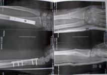 arm.jpg