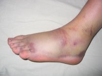 IMG_377311.JPG