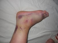IMG_377611.JPG
