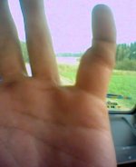 uppfuckat finger.jpg
