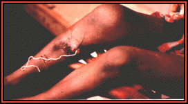 index_clip_image001.gif