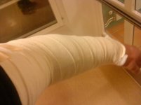 arm.jpg