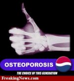 Osteoporosis-Pepsi--23734.jpg
