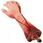 avhuggen-arm.jpg