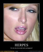 demotivational-posters-herpes.jpg