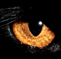 ablackeye.gif