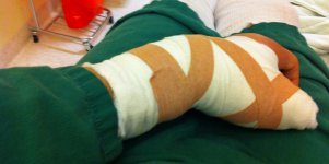 Post-Op.jpg