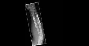 arm.jpg