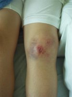 P4180012 (Medium).JPG