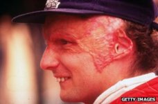 _70023755_lauda304.jpg