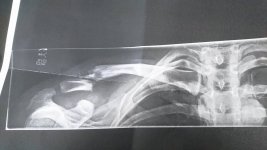 20629229_10155898504016840_1006910152_o.jpg