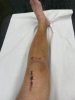 thumbnail_IMG_5327.jpg