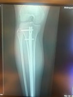 IMG_0336.jpeg
