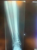 IMG_0335.jpeg