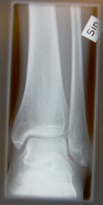 PICT0095.JPG