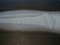 P1010038.JPG